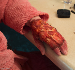 Stage Prosthetic